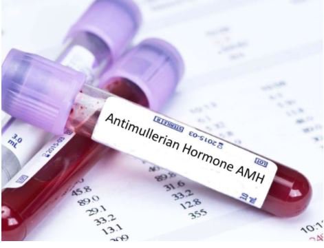 dự trữ buồng trứng thấp