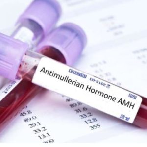 dự trữ buồng trứng thấp